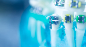 矯正歯科治療前のアドバイス