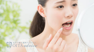 不正咬合の種類と原因について