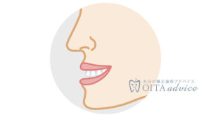 下顎前突（受け口・しゃくれ）