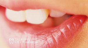 出っ歯の症状と治療方法