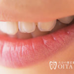 過蓋咬合（かみ合わせが深い）